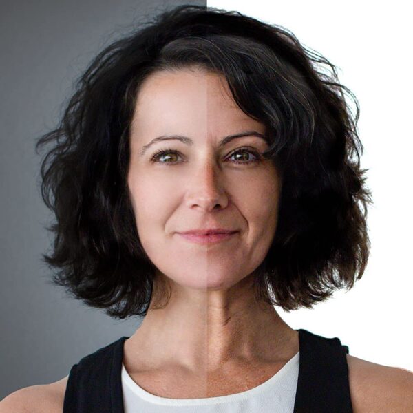 Dispositivo de Radiofrequência Facial - Image 6